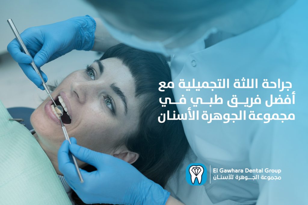 جراحة اللثة التجميلية