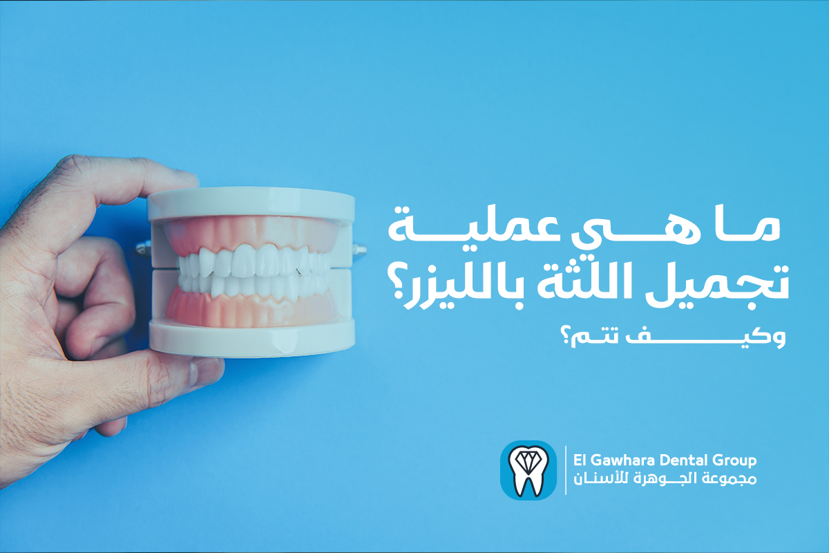 عملية تجميل اللثة بالليزر