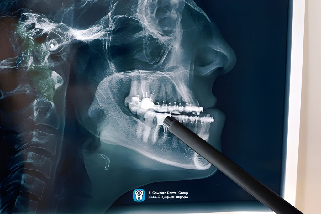 اشعة مقطعية على الاسنان