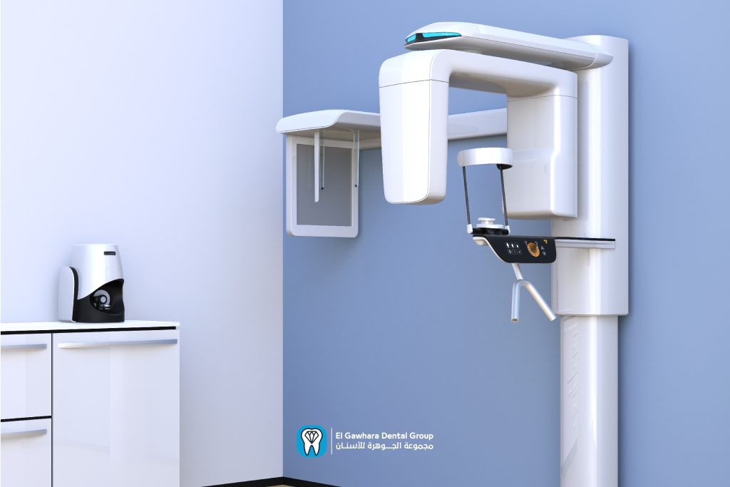 اشعة مقطعية على الاسنان