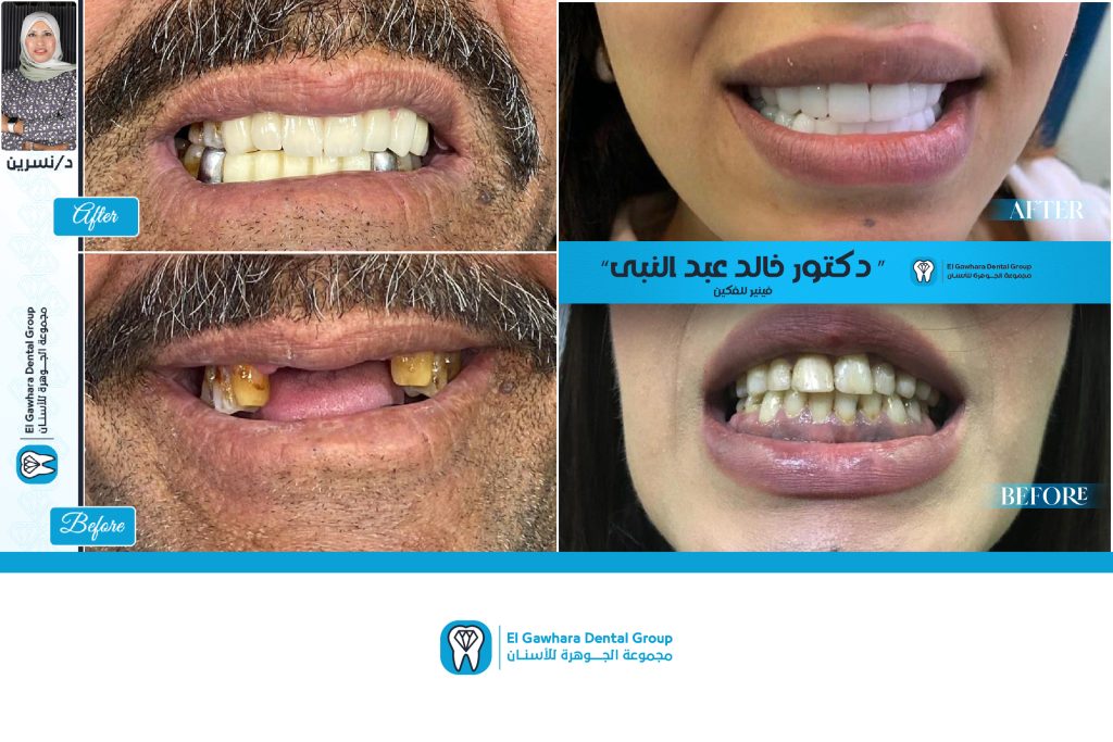 مركز الجوهرة للاسنان بالورديان