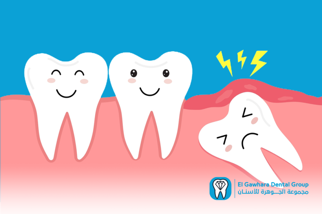 تورم اللثة اسبابه وعلاجه​