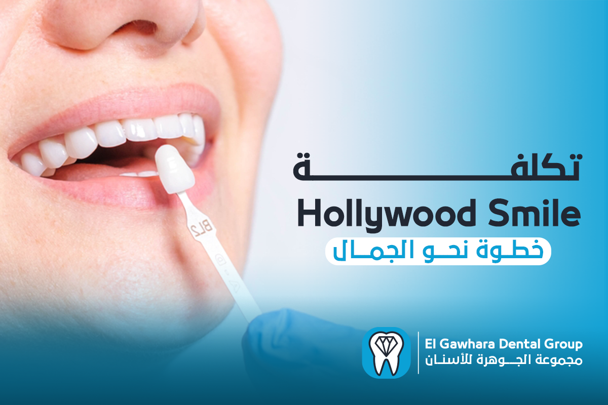 تكلفة hollywood smile