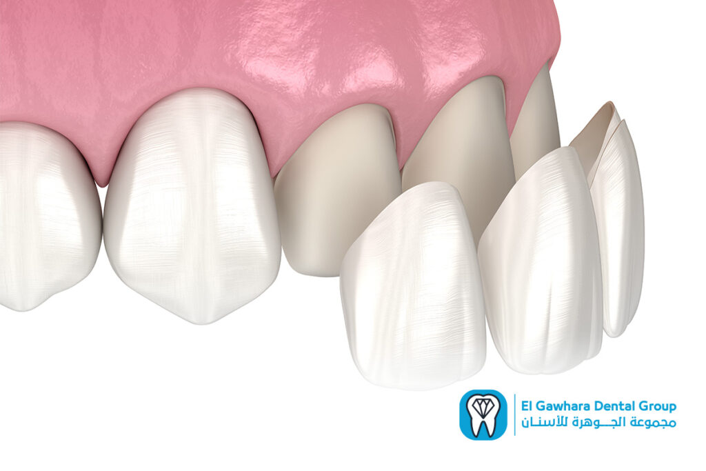 مركز تجميل الاسنان بالاسكندريه​