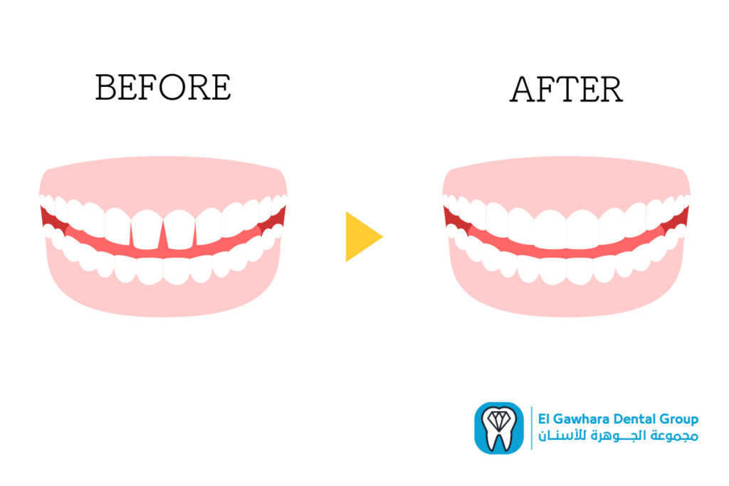 مركز تجميل الاسنان بالاسكندريه​