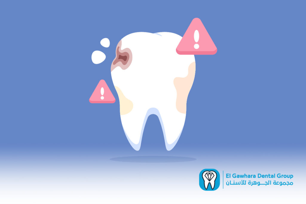 اسباب تاكل عظام الاسنان​