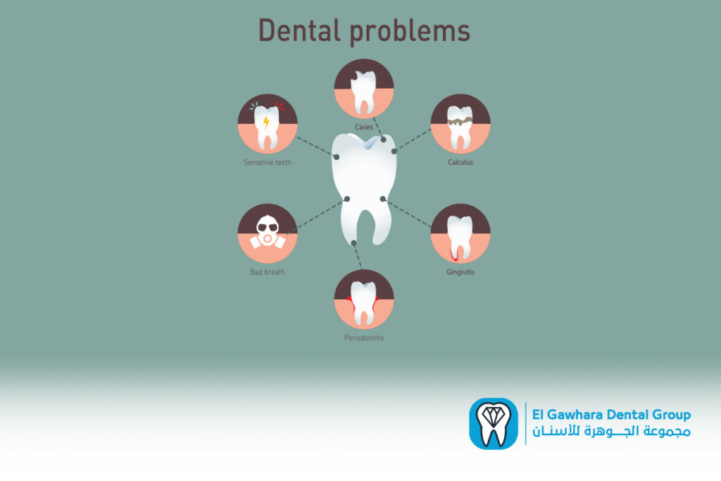 مشاكل تركيبات الاسنان الثابتة​